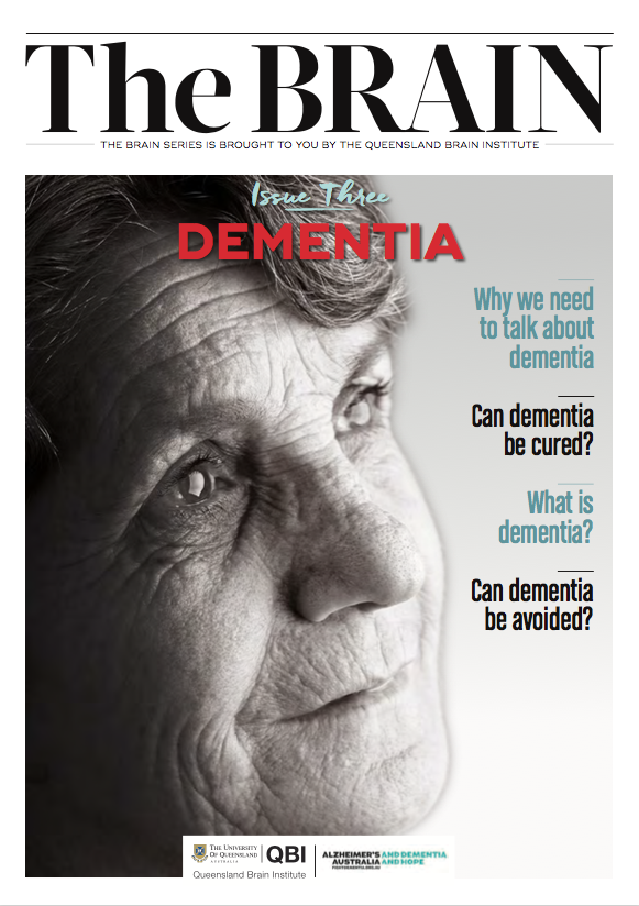 Online dementia publication sheds light on latest research UQ News